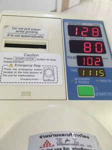 高血圧によるめまい